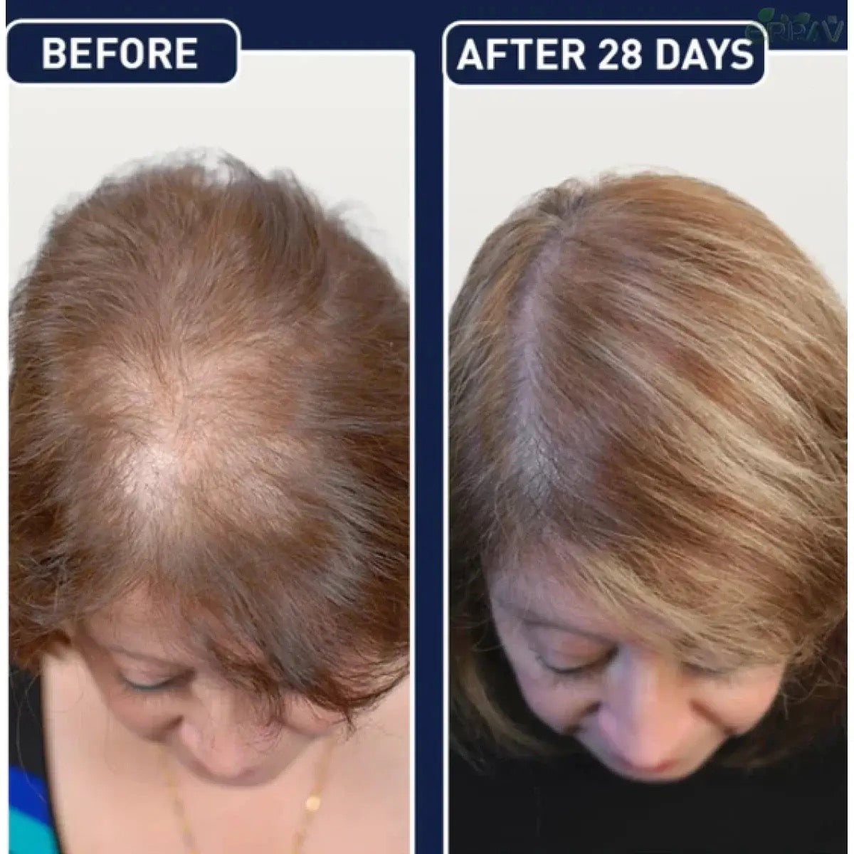 FEG Organic Hair Growth Oil