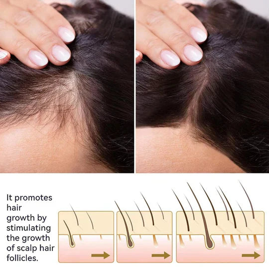 FEG Organic Hair Growth Oil